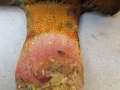 Rubroboletus legalliae - Legals Dickrhrling - Hrsingen
